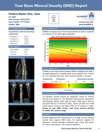 AutoBMD Sample Report